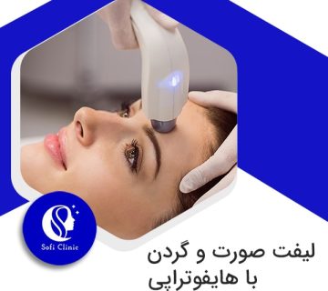 لیفت صورت و گردن با هایفو