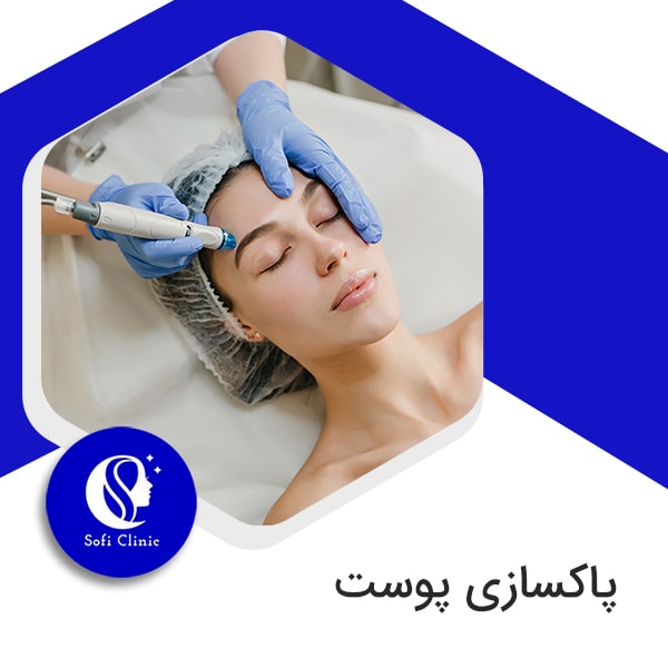 پاکسازی پوست با پلاژن تراپی