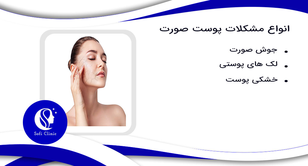 انواع مشکلات پوست صورت