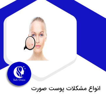 مشکلات پوست صورت