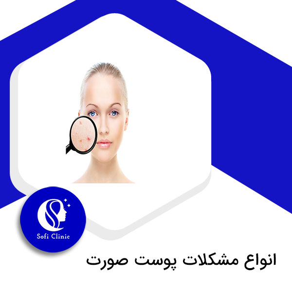 مشکلات پوست صورت