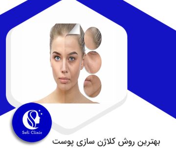 بهترین روش کلاژن سازی پوست