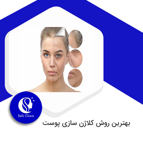 بهترین روش کلاژن سازی پوست