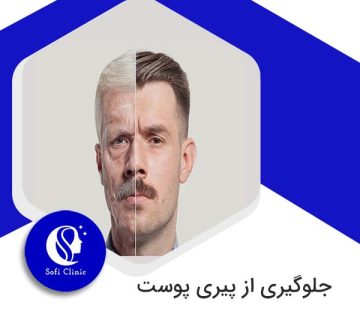 جلوگیری از پیری پوست