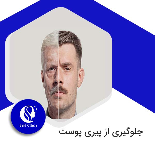 جلوگیری از پیری پوست