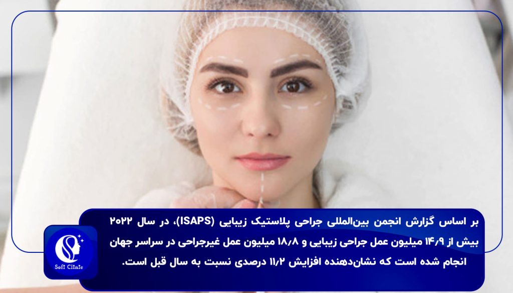 تأثیر لیفت صورت در زیبایی و اعتماد به نفس
