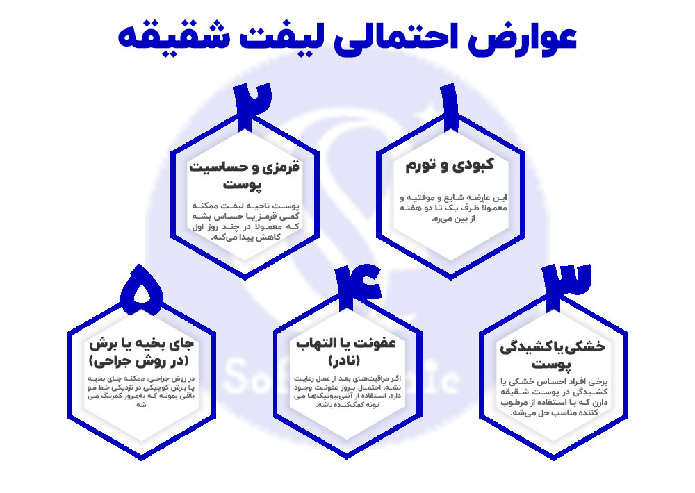 عوارض احتمالی لیفت شقیقه